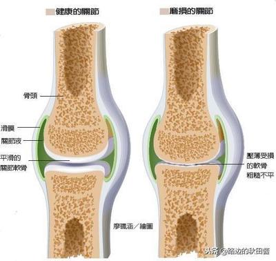 膠原蛋白對(duì)骨骼的功效與作用
